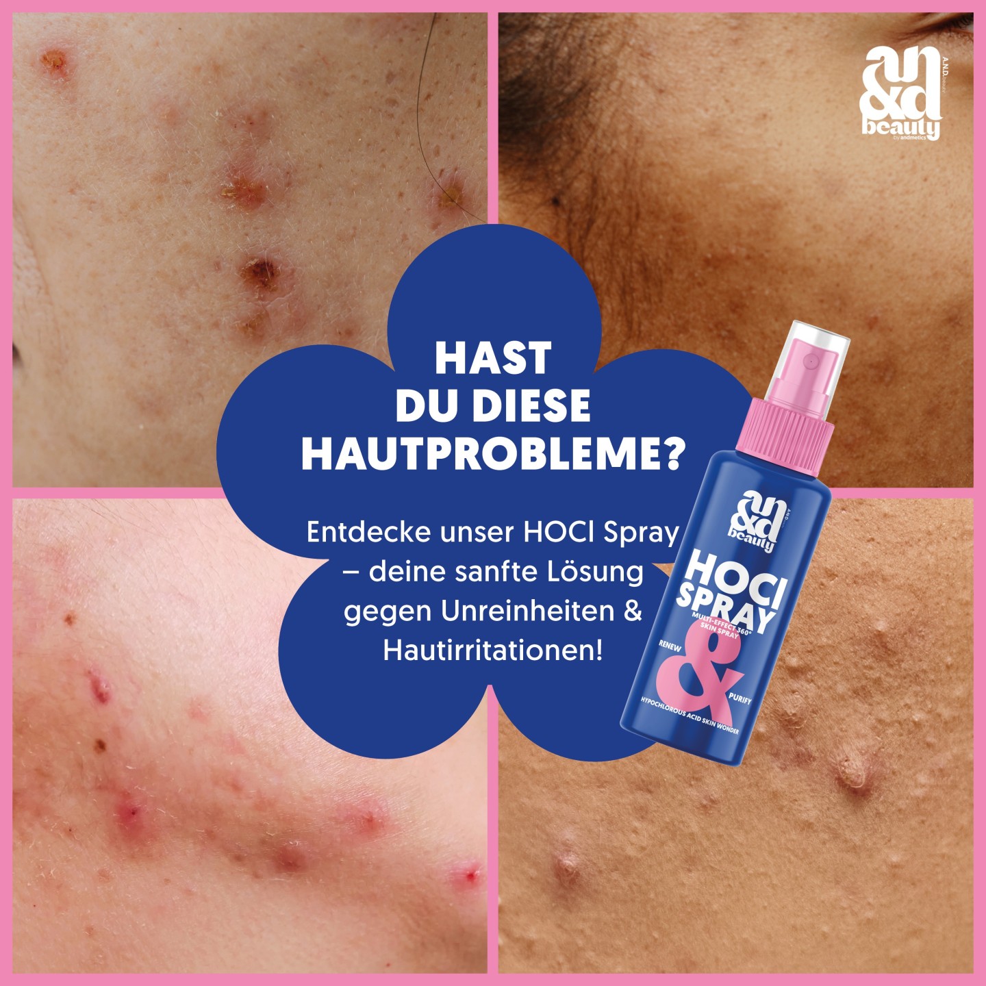 HOCl Spray – Multi Effekt 360° Skin Spray | A.N.D. Beauty