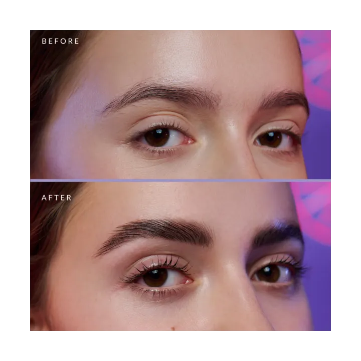 Korean BROW Lifting
